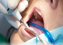 Clínica Dental Bell - Dent paciente en procedimiento dental